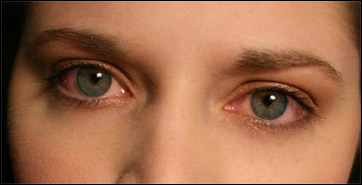 bloo-shot eyes contact lenses